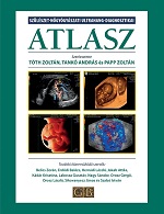 Knyv: Szlszet-ngygyszati ultrahang-diagnosztikai atlasz ( Tth Zoltn, Tank Andrs, Papp Zoltn ) - White Golden Book kiad - orvosi knyv, szakknyv, knyvkiads