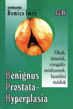 Knyv: Benignus prostatahyperplasia ( Romics Imre (szerkesztette) ) - White Golden Book kiad - orvosi knyv, szakknyv, knyvkiads